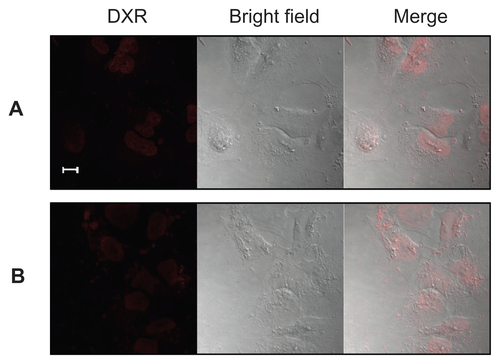 Figure S2 Confocal laser scanning microscopy image of A549 cells incubated with F–PLL-coated liposomal DXR for 3 hours at 37°C (A) without or (B) with 5 mM FA in culture medium.Note: The scale bar represents 10 μm.Abbreviations: DXR, doxorubicin; FA, folic acid; F-PLL, folate-poly(L-lysine).