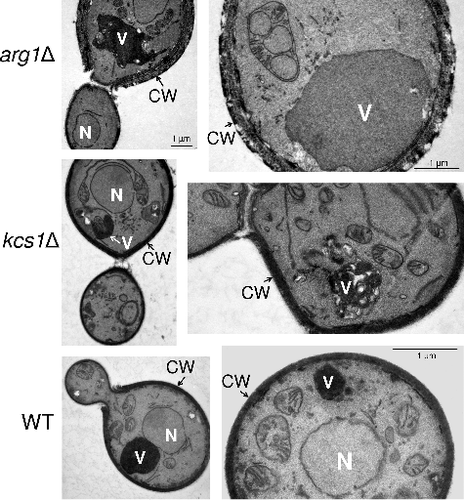 Figure 5. Transmission electron microscopy (TEM) demonstrating that arg1Δ cell walls are thicker than, and structurally different to, those of WT and kcs1Δ, and that arg1Δ cells have larger vacuoles. N: nucleus; CW: cell wall; V: vacuole