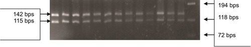 Figure 2 PCR-RFLP in patients for P.T54A variant in the DAZL gene. The 262 bps PCR product was digested with Alu 1 and resolved on 4% agarose gel. All lanes from 1 to 13 show a normal digestion pattern with the 142 and 115 bps bands, where the 5 bps band was invisible. The phi X174 DNA-Hae III ladder was used to size the digested bands.