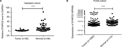 Figure 1 SYNPO2 expression in BC in validated cohort and TCGA cohort.Notes: (A) SYNPO2 expression was examined by qRT-PCR in 38 paired human BC tissues and adjacent noncancerous tissues (paired t-test, P<0.001). A logarithmic scale of 2−ΔΔCt is used to represent the fold change in quantitative real-time PCR detection. (B) The TCGA cohort contained 1,100 breast tumor tissues and 113 normal tissues. RPKM was represented for expression of SYNPO2. The analysis was done using the Mann–Whitney U-test. ****P<0.0001.Abbreviations: BC, breast cancer; qRT-PCR, quantitative reverse transcription polymerase chain reaction; RPKM, reads per kilobase per million; SYNPO2, synaptopodin 2.