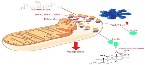 Figure 2. Synergistic effect of dexamethasone with venetoclax. Release of IL-6 result in an increase in the affinity of BIM (anti-apoptotic protein) towards MCL-1 (another member of the anti-apoptotic proteins) that result in blocking apoptosis independently from BCL-2, which bypass the effect of venetoclax. Dexamethasone is a potent anti-inflammatory agent that inhibits the effect of IL-6, restoring the sensitivity of the malignant plasma cell to venetoclax.