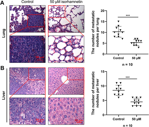 Figure 12 The effect of isorhamnetin on in vivo metastasis of GC cells. (A and B) After 4 weeks of transplantation, all mice were euthanized, their lungs and livers were collected and fixed with 4% paraformaldehyde. Then, H&E staining was used to detect the metastasis of lung and liver in each group of mice. ***P<0.001.