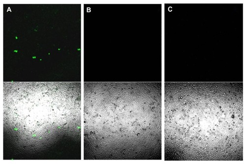 Figure 6 (A) COS7 cells exposed to 30 seconds of insonation in presence of pDNA-loaded nanobubbles carrying 10 μg/mL of pDNA and examined 24 hours post transfection by confocal laser scanning microscopy without fixation. (B) COS7 cells treated as in (A) but not sonified. (C) COS7 cells neither exposed to ultrasound nor to DNA-loaded nanobubbles.Note: The upper panels show fluorescence images while the lower panels show merged phase-contrast and fluorescence images.