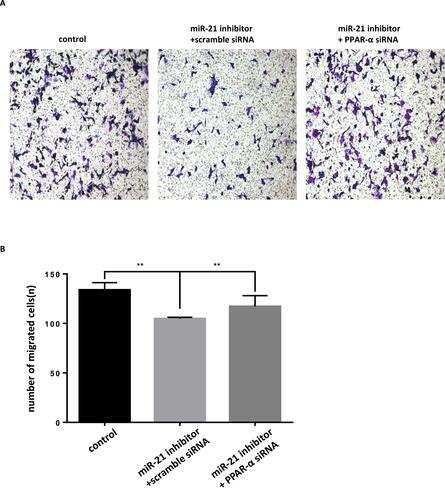 Figure 16 Co-transfection of PPAR-α siRNA and miR-21 inhibitor into cells, the effect on cell migration (A and B) Cell migration in cell lines was detected by transwell migration assay. n = 3 per group. **P<0.01.