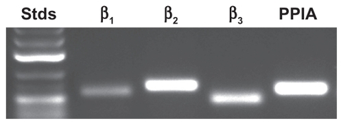 Figure 1 Gene expression analysis of β-adrenergic receptor expression in DAOY medulloblastoma cells. Total RNA was extracted from medulloblastoma-derived DAOY cells and semi-quantitative RT-PCR performed as described in the Methods section. cDNA amplicons were resolved on an agarose gel in order to confirm a single amplification product.
