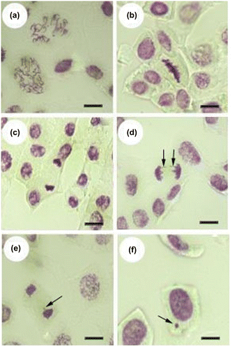 Figure 4. Mitotic abnormalities induced by deltamethrin in root meristem cells of sunflowers: (a) disturbed prophase; (b, c) stickiness; (d) chromatid bridge; (e) laggards; (f) micronucleus (scale bars: 5 μm).
