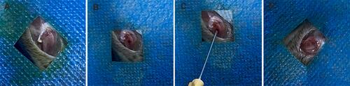 Figure 1 (A) The surrounding soft tissue was isolated, and distal femur was exposed. (B) Creation a 1 mm diameter distal femur defect. (C) Sterilized MSNs and bFGF@MSNs solution were injected into the bone defects. (D) Sealing of the opening of defect with bone wax.