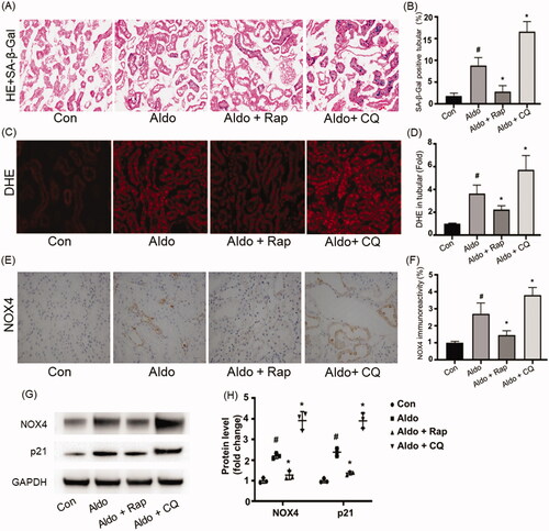 Figure 5. Autophagy regulated OS and senescence in PTCs of Aldo-induced rats. (A) Senescence-associated-galactosidase (SA-β-Gal) Staining in rat renal cortex (n = 6). SA-β-Gal is labeled by bright-blue in the PTCs. (B) Bar graph indicating the percentage of SA-β-Gal positive cells per field in tubular. (C) DHE staining of rat kidney sections (n = 6). (D) Bar graph indicating the mean DHE intensity per field in rat tubular cells. (E) Immunohistochemical staining for NOX4 in rat kidney tissues from various groups, as indicated (n = 6). (F) Bar graph indicating NOX4 immunoreactivity per field in rat tubular cells. (G) Western blot analysis revealed the expression of NOX4, p21, and GAPDH proteins after various treatments in rats (n = 3). (H) Graphical presentation shows the relative abundance levels of NOX4 and p21 after normalization with GAPDH (n = 3). #p < 0.05 vs. normal control, *p < 0.05 vs. Aldo alone.