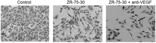 Figure 5. Effect of neutralizing antibody anti-VEGF on morphology of endothelial cells treated with ZR-75-30 cells secretome. HUVEC were treated with control medium, secretome of ZR-75-30 cells and secretome of ZR-75-30 cells plus neutralizing antibody anti-VEGF (150 ng/ml) for 24 h, and then stained with crystal violet.