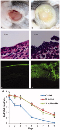 Figure 2. Photographs of (A) un-infected or (B) infected subcutaneous wounds in a mice, Gram staining of (C) un-infected and (D) infected wounds, (E and F) Fluorescence staining of biofilm components of un-infected and infected wounds, (G) wound re-epithelialization of wounds infected with S. aureus or S. epidermidis compared to un-infected wounds. Adapted with permission, from Schierle et al. [Citation60].