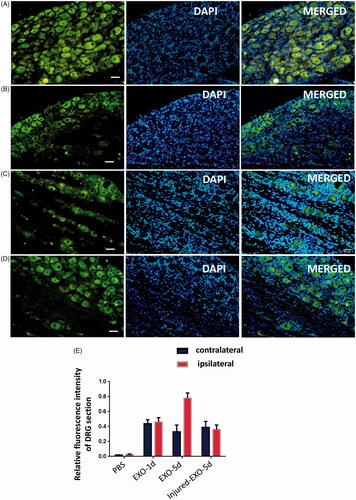 Figure 5. Exosome uptake by peripheral nerve endings and retrograde transport to DRG cells in vivo. Fluorescence micrographs (GFP, left; DAPI, middle; merged, right) showing the (A) ipsilateral side (injection side) of the DRG in a normal rat; (C) DRG section after the ipsilateral sciatic nerve was transectioned prior to exosome injection; and (B, D) contralateral side of the DRG in (B) normal and in a (D) rat where the right sciatic nerve was transectioned, respectively. Scale bar = 20 μm. (E) Profile showing the relative fluorescence intensities of the bilateral DRG in the PBS injection control group (PBS), at day 1 in the exosome injection group (EXO-1d), day 5 in the exosome injection group (EXO-5d), and day 5 in the injection in the ipsilateral sciatic nerve transectioned group (Injured-EXO-5d).