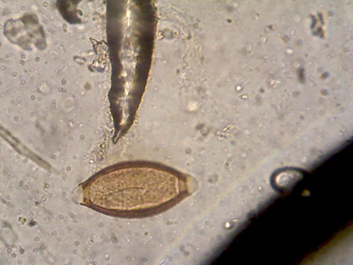 Figure 2 Trichuris egg.