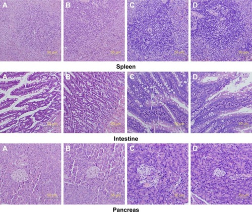 Figure 8 Histologic sections of spleen, intestine, and pancreas.Notes: (A) Male rats of nano-Cu/LDPE group. (B) Male rats of control group. (C) Female rats of nano-Cu/LDPE group. (D) Female rats of control group. No abnormalities were detected in any groups.Abbreviation: Cu/LDPE, copper/low-density polyethylene nanocomposite.