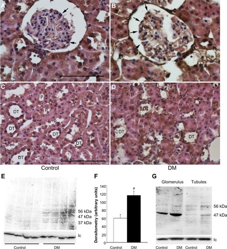 Figure 2 The uptake of exogenous human prorenin is enhanced in diabetic rats.