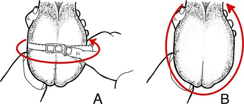 Figure 1. Scrotal latitudinal (A) and longitudinal (B) circumferences.