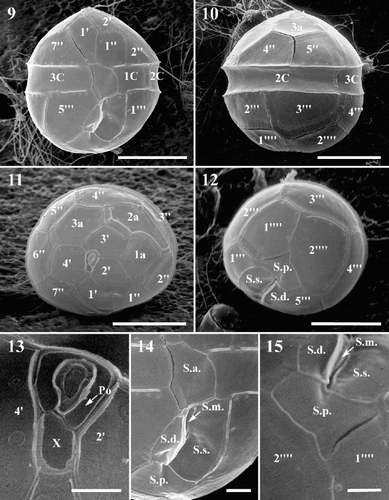 Figs 9–15. Scanning electron micrographs of Protoperidinium vorax sp. nov. Fig. 9. Ventral view. Fig. 10. Dorsal view. Fig. 11. Epitheca, apical view. Fig. 12. Hypotheca, antapical view. Fig. 13. Apical pore complex. Fig. 14. Sulcal area. Fig. 15. Sulcal posterior plate (S.p.), detail of Fig. 12. Abbreviations: see Figs 5 –8. Scale bars: Figs 9 –12 : 10 µm; Figs 14, 15 : 2 µm; Fig. 13 : 1 µm.