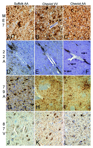 Figure 2. Main PrPd features in brains of sheep infected with ME7, 79A, 22A, or 87V. In ME7 infections (A-C), neuropil-associated PrPd types predominated, like-wise perineuronal, coalescing or diffuse punctate. A prominent characteristic of the 22A agent in sheep (D-F) was the glia-associated PrPd types like the perivascular and perivacuolar in the white matter with some plaque-like depositions (arrows) in particular in Cheviots of the ARQ/ARQ genotype. 79A infections (G-I) resulted in a combination of intraglial-coalescing pattern (G) with stellate-like labeling (H, I). Sheep infected with 87V (J-L) unequivocally showed most PrPd associated with neurons or glial cells. Immunohistochemistry for PrPd using R145 antibody. Magnifications: x10 (D-F, H and I); x20 (A-C, G, J-L).