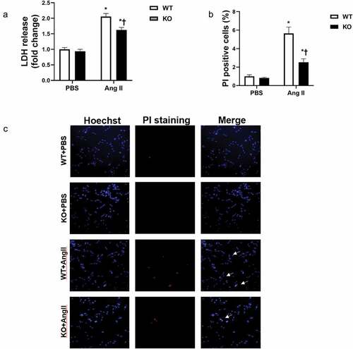 Figure 2. GSDMD deletion reduces Ang II-induced adult mouse ventricular myocytes (AMVMs) cardiomyocytes pyroptosis. a, Lactate dehydrogenase (LDH) levels of cardiomyocyte supernatants. b, PI-positive cardiomyocytes ratio. c, Cardiomyocytes necrosis by propidium iodide (PI) staining, white arrows indicate necrotic cardiomyocytes. WT, wild-type mice; KO, cardiomyocyte-specific GSDMD-knockout mice. *P < .05 versus the corresponding values of the PBS group; †P < .05 versus the corresponding values of the PBS WT group.