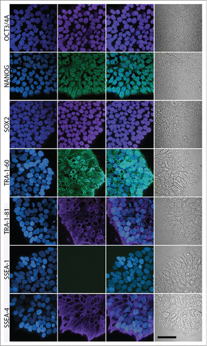 Figure 5. Confocal microscopy-based immunocytochemical analysis of the expression of ESC markers in AF-iPSC in their mature state grown in VTN/E8. Images of colonies of D1 line are depicted on the figure. Oct3/4A, Nanog and Sox2 displayed clear signal localized in the nucleus while TRA-1-60, TRA-1-81 and SSEA-4 displayed surface localization. SSEA-1 was negative. The projections were reconstructed from the fluorescence signal spanning all of the individual scanned slices using the Maximum Intensity Projection algorithm. The first column contains DAPI images, second column contains marker fluorescence, third column contains DAPI and marker overlay images and the fourth column contains a single-slice leftover transmitted light-based representation of the same colonies. Scale bar = 50 µm.