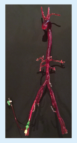 Figure 5. Completed arterial prototype.