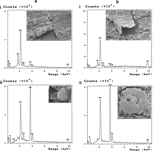 Figure 2 Example of SEM and EDX analyses performed on the intraluminal surface of transfer sets removed from two patients (a and b). Biofilm overview (i) and specific encrustations (ii) observed by SEM are shown as inserts to the corresponding EDX spectrum illustrating the elemental composition. Au (from sputtering-coating of samples) and Si (from the catheter wall) are not elements originating from the biofilms.