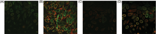 Figure 2. Distribution of Hsp27 (green fluorescence) and Hsp70 (red fluorescence) in PC3 cells (A) unheated (maintained at 37°C in incubator) and (B) heated (T = 44°C for 5 min) and RWPE-1 cells (C) unheated and (D) heated at T = 44°C for 5 min.