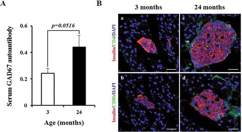 Figure 3. Aged islets do not exhibit β-cell destruction. (A) Serum levels of GAD67 IgG autoantibodies with aging. Y axis represents optical density values. n = 3 mice of each age group. (Ba–d) Representative confocal images of young and aged islets stained for nuclei (DAPI, blue), insulin (red), CD4 (green in a and c) and CD8b (green in b and d). n = 3 mice of each age group. Scale bars = 50 μm.