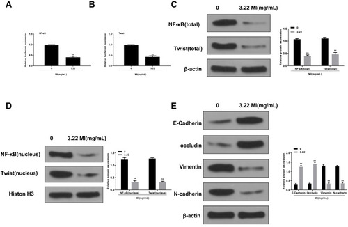 Figure 4 MI inhibits transcriptional activation and expression of NF-κB and Twist and alleviates EMT in laryngeal cancer cells. (A) The luciferase activities of NF-κB were determined by luciferase reporter gene assays in the HEP-2 cells treated with MI at indicated dosage. (B) The luciferase activities of Twist were determined by luciferase reporter gene assays in the HEP-2 cells treated with MI at indicated dosage. (C) The total expression of NF-κB, Twist, and β-actin was measured by Western blot analysis in the HEP-2 cells treated with MI at indicated dosage. The results of Western blot analysis were quantified by ImageJ software. (D) The nucleus expression of NF-κB, Twist, and histone H3 was tested by Western blot analysis in the HEP-2 cells treated with MI at indicated dosage. The results of Western blot analysis were quantified by ImageJ software. (E) The expression levels of E-Cadherin, occluding, vimentin, N-cadherin, and β-actin were analyzed by Western blot analysis in the HEP-2 cells treated with MI at indicated dosage. The results of Western blot analysis were quantified by ImageJ software. Data are presented as mean ± SD. Statistic significant differences were indicated: ** P < 0.01.