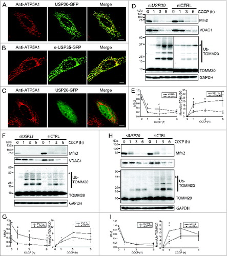 Figure 1. USP30 and USP35 are mitochondrial DUBs that may affect mitophagy. (A-C) HeLa cells expressing USP30-GFP (A), USP35-GFP (B), or USP20-GFP (C) were fixed and immunostained for GFP 24 h after transfection. anti-ATP5A1 antibody was used to identify mitochondria. (D-I) HeLa cells stably expressing GFP-PARK2 were transfected with siRNA against USP30 for 72 h. Cells were treated with 10 µM CCCP for 0, 1, 3, and 6 h as indicated and the cell lysates were examined for MFN2, VDAC1, and ubiquitinated-TOMM20 levels by immunoblotting. The average of normalized density of MFN2 and monoubiquitinated TOMM20 was plotted (n = 3, P < 0.05). (F-I) The same experiment was performed with cells that received siRNA against USP35 (F) or USP20 (H). The average of normalized density of MFN2 and monoubiquitinated TOMM20 was also analyzed (G-I). Scale bar: 10 µm.