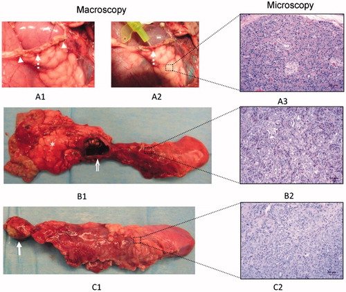 Figure 3. Macroscopic and microscopic patterns founded in the distal remnant pancreas: 1) Pancreatic leak (broken arrow, A1) from the distal stump observed in animal 4 of the ST group that died on day 2 PO. The origin of the leak was easily canalised with a probe (broken arrow, A2) between some staples (arrowhead). Histologically no signs of atrophy were described (A3); 2) Pseudocyst (open arrow, B1) accompanied by partial atrophy (B2) in the distal pancreas; 3) Complete atrophy of the distal remnant pancreas (C1, C2). This occurred mostly in the RF group, in which an area of coagulative necrosis was always observed (arrow). In any case, the proximal pancreas was well preserved with no signs of atrophy (asterisk).