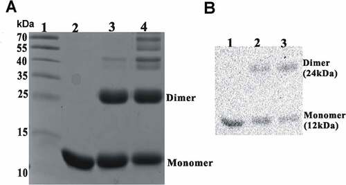 Figure 6. Rv0081 forms dimer. Purified Rv0081 protein was cross-linked by treatment with glutaraldehyde and then analyzed by SDS-PAGE and Coomassie blue staining (a) or Western blot (b). (a) lane 1: molecular weight marker; lane 2: Rv0081 without glutaraldehyde treatment; lanes 3 &4: Rv0081 treated with glutaraldehyde for 30 sec and 1 min, respectively. (b) Lanes 1: Rv0081 without glutaraldehyde treatment; lanes 2 & 3: Rv0081 treated with glutaraldehyde for 30 s and 1 min, respectively.