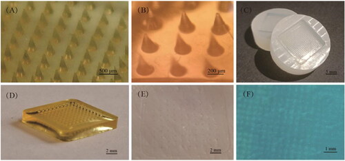 Figure 1. HA MNP was prepared by Huizhi Kang using the micro-molding method. (A) HA MNP (20 × 20 arrays) images photographed by a digital camera. (B) Bright-field micrograph of HA MNP (C) PDMS MNP molds (20 × 20 arrays). (D) Physical picture of HA MNP (10 × 10 arrays). (E) Mechanical strength test of HA MNP inserted into pig skin. (F) Pig skin after Trypan Blue staining.