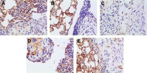 Figure 14 Immunohistochemical staining for Bcl-2 of orthotopic tumors in all the groups.Notes: (A) Positive group, (B) combination group, (C) test group, (D) reference group, and (E) model group. Magnification ×400.Abbreviation: Bcl-2, B-cell lymphoma-2.
