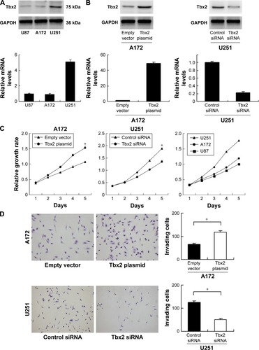 Figure 2 Tbx2 overexpression correlates with proliferation and invasion.