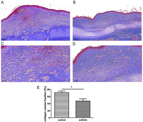 Figure 4 Histopathological images of Masson stained HS after treatment. (A–D) In contrast with that in the control group ((A), ×40, (C), ×100, n = 20), collagen fibers were loose and regularly arranged in the axitinib group ((B), ×40, (D), ×100, n = 20). (E) The value of collagen volume fraction (CVF, %) was significantly decreased in the axitinib group (n = 20 per group). *P < 0.05.