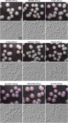 Figure 3. Colony and cellular morphologies of the different C. auris strains. Strains XM1803, XM1805, C1921, C1922, NSICU1, RICU4, and BJCA001 were isolated from China. The MTLa strains, CBS12766 and B11245, were isolated from India and Venezuela, respectively. Yeast-form cells were plated onto YPD medium supplemented 5 μg/mL of phloxine B and incubated at 25°C for seven days. Scale bar = 10 μm.