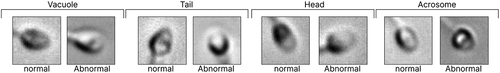 Figure 2. Images and labels of MHSMA dataset for different parts of sperm such as vacuole, tail, head, and acrosome.
