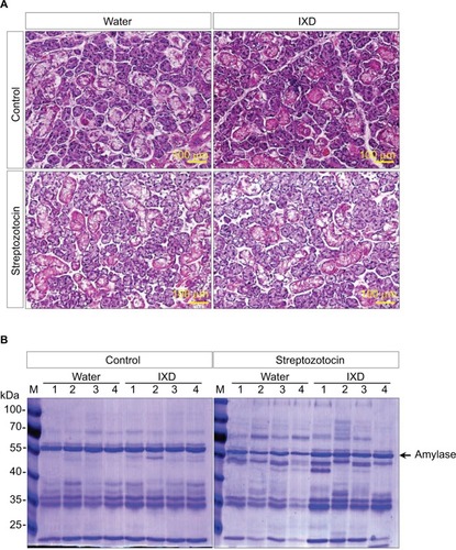 Figure 3 Effects of IXD extract on the morphology of submandibular glands and in salivary total protein expression.