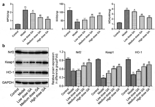 Figure 3. The oxidative stress in WAS rats was dramatically suppressed by GA. A. The concentration of MDA, SOD, and GSH was determined by ELISA assay. B. The expression of Nrf2, Keap1, and HO-1 was determined by Western blotting assay (**p < 0.01 vs. Control, #p < 0.05 vs. Model, ##p < 0.01 vs. Model)
