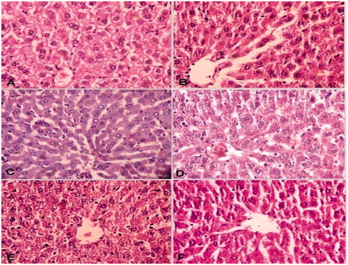 Figure 4. Effect of MECA on liver histopathology of ethanol treated rats. A = Normal control; B = Ethanol control: 40% Ethanol – 4 g/kg; C = Ethanol control + silymarin (100 mg/kg); D = Ethanol control + self recovery; E = Ethanol control + MECA (300 mg/kg); F = Ethanol control + MECA (600 mg/kg).