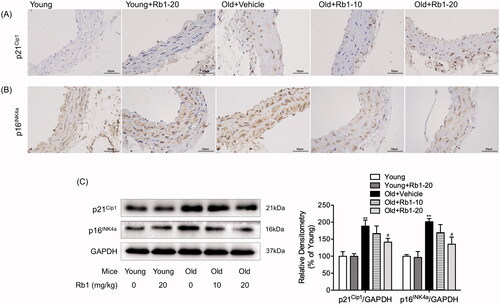 Figure 1. Effect of Rb1 on thoracic aorta senescence. Images of the immunohistochemical staining (400 ×) of p21Cip1 (A) and p16INK4a (B) in mouse thoracic aorta cross sections. (C) Western blot analysis of mouse thoracic aortic p21Cip1 and p16INK4a expression. The data are expressed as the mean ± SD. **p < 0.01 vs. the Young group; #p < 0.05 vs. the Old + Vehicle group.