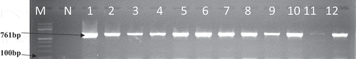 Figure 8. A gel electrophoresis showing the tetL gene
