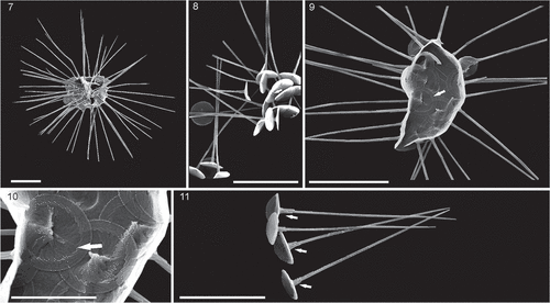 Figs 7–11. SEM micrographs of Palusphaera vandelii. Scale bar = 5 μm for Figs 7, 8, 9, 11