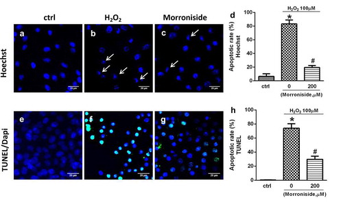 Figure 2. MR inhibits H2O2-induced apoptosis of OLN-93 cells. (a–d) Apoptotic nuclei of OLN-93 cells were stained by Hoechst 33342. The arrow indicates condensed nuclear cells. (a) Control group; (b) cells induced by H2O2 (100 µM) with condensed nuclei; (c) cells administrated with 200 µM MR for 24 h displayed attenuated sensitivity to H2O2 (100 µM), as evidenced by fewer cells with condensed nuclei. (e–h) Apoptotic cells were detected by TUNEL (green), and the nuclei were detected by DAPI (blue). (e) Control group; (f) cells induced by H2O2 (100 µM) with condensed nuclei; (g) cells were administrated with 200 µM MR followed by 100 µM H2O2 for 12 h. Quantitative analyses are shown in panels (d) and (h). Scale bar, 20 µm. *P< 0.01 vs. the control group; #P< 0.01 vs. the only H2O2 treatment group