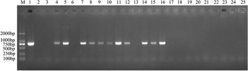 Figure 2. Identification of the ermF gene in a subset of clinical R. anatipestifer isolates by PCR amplification. Samples were electrophoresed on a 1% agarose (w/v) gel. The ermF gene was amplified by PCR using primers Erm F and Erm R. Lane 1: R. anatipestifer CH-1 genomic DNA was used as positive control template. Lane 2–24: subset of clinical R. anatipestifer isolates. Lane 25: distilled water as negative control template. M: DNA Marker 2000.