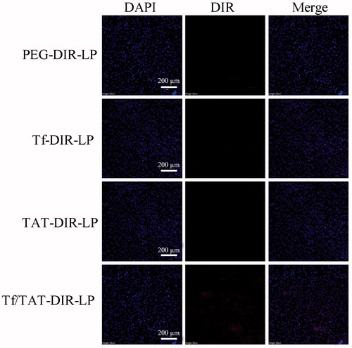 Figure 11. CLSM images of tumor sections from B16 bearing mice 24 h after systemic administration of DIR-loaded liposomes. The Tf/TAT-DIR-LP showed the most obvious fluorescence of DIR among these group in tumor section, while other groups only little fluorescence.