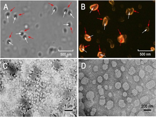 Figure 7 Fluorescence photographs of the PCC liposomes under white light (A) and 415 nm light excitation (B). TEM images of PCC liposomes. Scale bar = 1 μm (C) and 200 nm (D).Notes: Red arrows represent pheophorbide-a in the outer shell and white arrows represent Camellia sapogenin derivative in the inner core of PCC liposomes.Abbreviations: PCC, photo-responsive Camellia sapogenin derivative cationic; TEM, transmission electron microscopy.