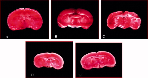 Figure 1. Effect of methanol extract of Stereospermum suaveolens in global cerebral ischemia/reperfusion-induced oxidative stress evaluated by 2,3,5-triphenyltetrazolium chloride (TTC) staining. Brain coronal sections were prepared (2 mm thickness) and then each section was stained with TTC. A: Sham group (normal saline 10 ml/kg), B: Control (normal saline 10 ml/kg + ischemia 30 min followed by 4 h reperfusion), C: MES 125 mg/kg + ischemia 30 min followed by 4 h reperfusion, D: MES 250 mg/kg + ischemia 30 min followed by 4 h reperfusion, E: MES 500 mg/kg + ischemia 30 min followed by 4 h reperfusion. In plate B, a large infarction area was observed in gray matter and less in brain stem. In plates C, D, and E, the infarction area was markedly reduced in rat brains treated with MES, and this reduction in infarction in treated rats were comparable with the sham group (A). MES = methanol extract of Stereospermum suaveolens.