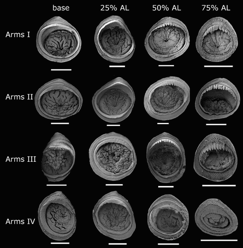 Figure 23 Idioteuthis cordiformis arm suckers, NMNZ M.181333, ♂, ML 181 mm. Scale bars = 500 µm.