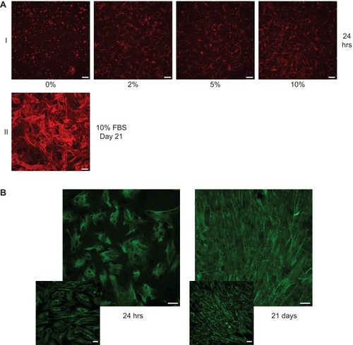 Figure 5 Cytoskeletal integrity, cell morphology, and cell identity. (A) Alexa fluor 594 conjugated phalloidin was used to evaluate cytoskeletal integrity and cell morphology of human mesenchymal stem cells (hMSCs) when they were seeded on low-oxygen graphene (LOG) in presence of growth media containing 0, 2, 5, 10% fetal bovine serum (FBS). Cells were fixed with 4% paraformaldehyde after 24 hrs and stained to visualize F-actin (I). Cells were incubated on LOG surface for 21 days in 10%FBS containing media to ensure that the cell integrity and morphology are maintained during the 3-week period of osteogenic differentiation (II). (B) Expression of vimentin in hMSCs confirmed their identity. Vimentin was used to image cells during cell adhesion ie within 24 hrs (I) and differentiation ie at day 21 (II) on low-oxygen graphene (LOG) surfaces. The insets show fluorescent staining of hMSCs on tissue culture polystyrene surface.